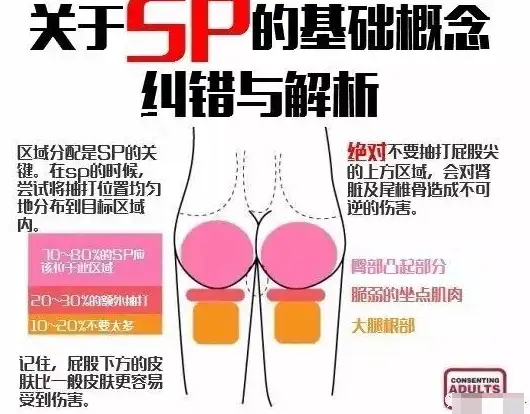 SP是什么？应该怎么打？插图16