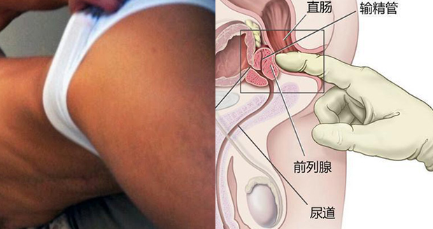 取前列腺液没想象中那么痛苦
