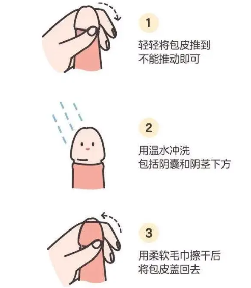 清洗“小丁丁”,如何更健康?!插图2