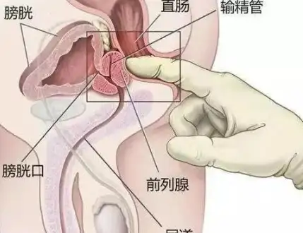 如何才能让前列腺达到巅峰状态插图2