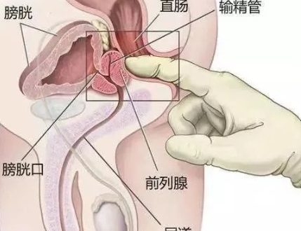 如何才能让前列腺达到巅峰状态插图2