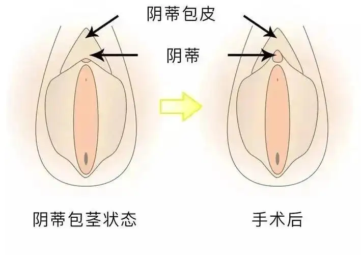 关于女性小豆豆的秘密......插图12