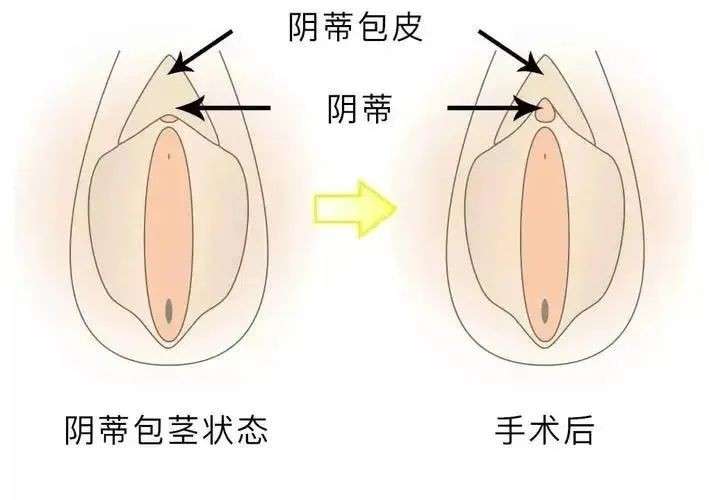 关于女性小豆豆的秘密......插图12