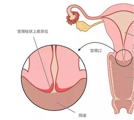 顶到「花芯」是什么感觉插图2
