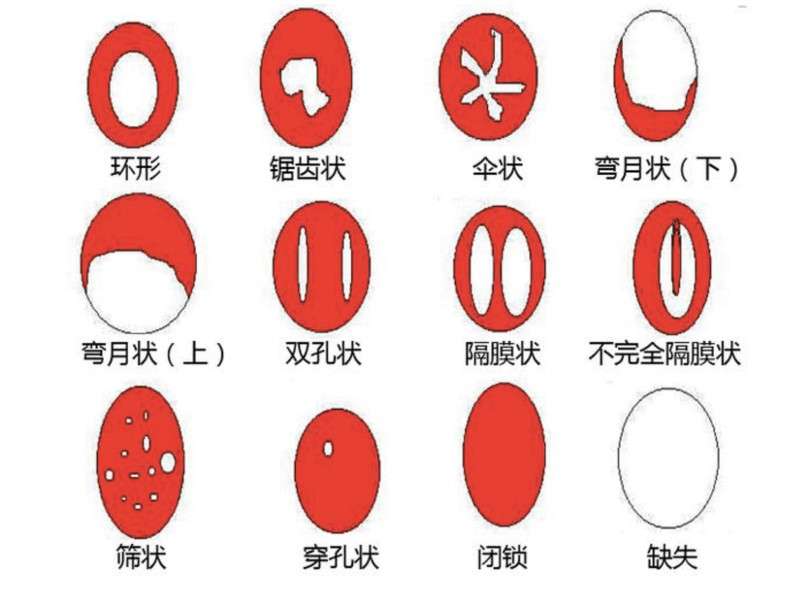 初夜必须有血？膜说：求你们别再给我加戏了！插图8